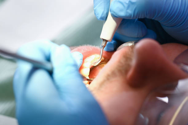 Best Pediatric Emergency Dentist in Mobile, AL